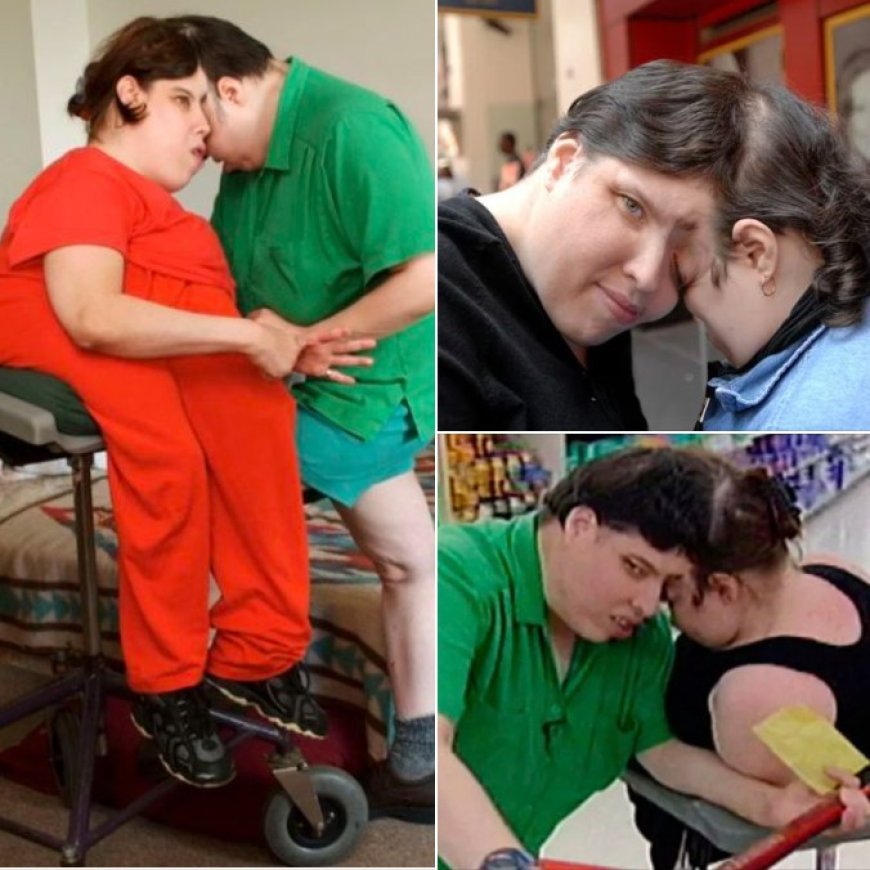 World’s oldest conjoined twins, Lori and George, have di. ed