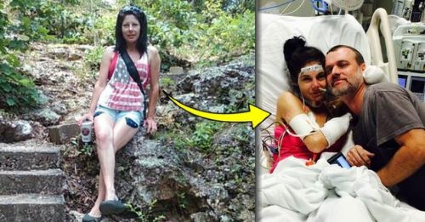 Woman’s Limbs Turn Black After Vacation Now She’s Quadruple Amputee