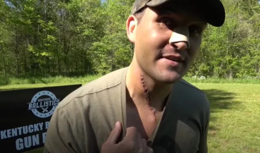 VIDEO Man Sustains Horrific Injuries After His Rifle Exploded