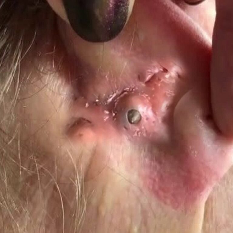 ២